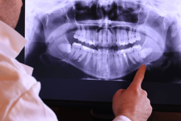 Best Emergency Treatment for Jaw Pain or Injury in Brewerton, NY