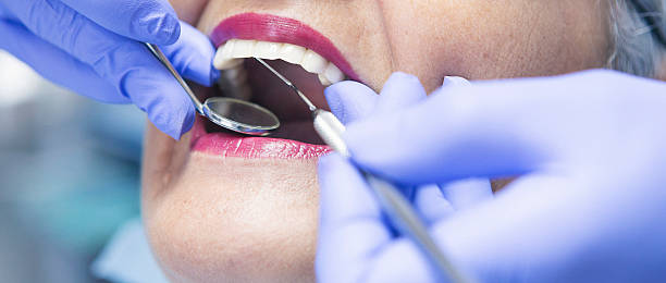 Best Emergency Dental Care for Sports Injuries in Brewerton, NY